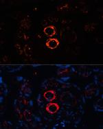 MYH11 Antibody in Immunocytochemistry (ICC/IF)