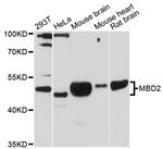 MBD2 Polyclonal Antibody