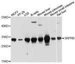 SRPRB Antibody in Western Blot (WB)