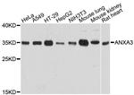 Annexin A3 Polyclonal Antibody