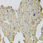 CKMT2 Polyclonal Antibody