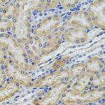 PCSK9 Polyclonal Antibody