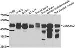 CK1 gamma-2 Antibody in Western Blot (WB)
