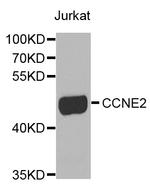 Cyclin E2 Polyclonal Antibody