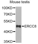 ERCC8 Polyclonal Antibody
