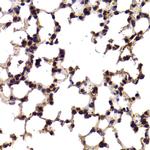 SF1 Polyclonal Antibody