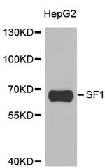 SF1 Antibody in Western Blot (WB)