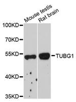 gamma Tubulin Polyclonal Antibody