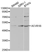 ACVR1B Polyclonal Antibody