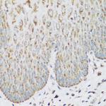 IGF2BP3 Antibody in Immunohistochemistry (Paraffin) (IHC (P))