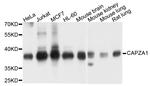 CAPZA1 Polyclonal Antibody