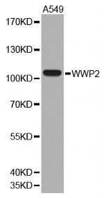 AIP2 Polyclonal Antibody