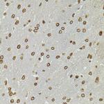 CDX2 Polyclonal Antibody