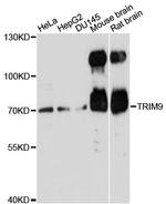 TRIM9 Polyclonal Antibody