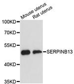 SERPINB13 Polyclonal Antibody
