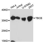 CKAP1 Antibody in Western Blot (WB)