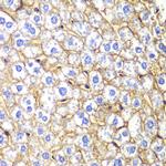 N-cadherin Polyclonal Antibody