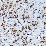 C/EBP beta Polyclonal Antibody