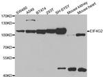 DAP5 Antibody in Western Blot (WB)