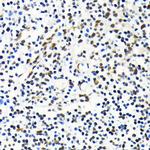 MKL1 Antibody in Immunohistochemistry (Paraffin) (IHC (P))