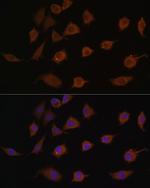 LSM1 Polyclonal Antibody