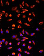 GCSH Antibody in Immunocytochemistry (ICC/IF)