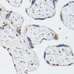 Adenosine Kinase Polyclonal Antibody