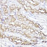 Aquaporin 1 Polyclonal Antibody
