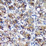 PYCR2 Polyclonal Antibody