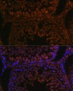 TPD52L3 Antibody in Immunocytochemistry (ICC/IF)