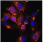 ADFP Polyclonal Antibody