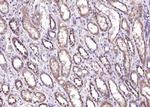ADSL Polyclonal Antibody