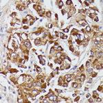 Angiotensinogen Polyclonal Antibody