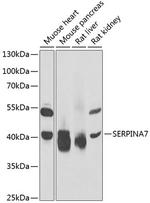 SERPINA7 Polyclonal Antibody