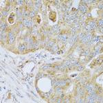 PSG1 Polyclonal Antibody