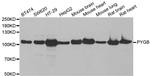 GPBB Polyclonal Antibody