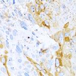 HAI-1 Polyclonal Antibody