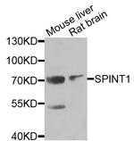 HAI-1 Antibody in Western Blot (WB)