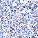CD43 Antibody in Immunohistochemistry (Paraffin) (IHC (P))