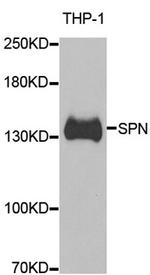 CD43 Antibody in Western Blot (WB)