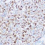 Monoacylglycerol Lipase Antibody in Immunohistochemistry (Paraffin) (IHC (P))