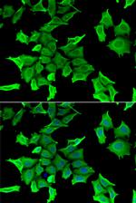 HAI-2 Polyclonal Antibody