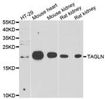 TAGLN Polyclonal Antibody