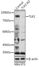 TLK2 Polyclonal Antibody