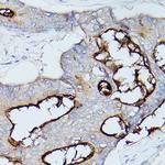 CEACAM1 Polyclonal Antibody
