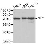 NF2 Antibody in Western Blot (WB)