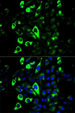 Granzyme B Polyclonal Antibody