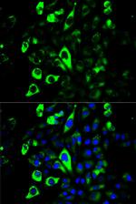 Granzyme B Antibody in Immunocytochemistry (ICC/IF)