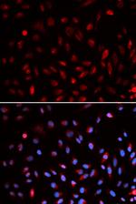 ERCC1 Antibody in Immunocytochemistry (ICC/IF)
