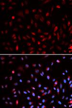 ERCC1 Polyclonal Antibody